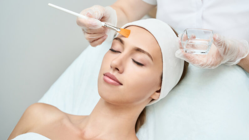 Chemical peels