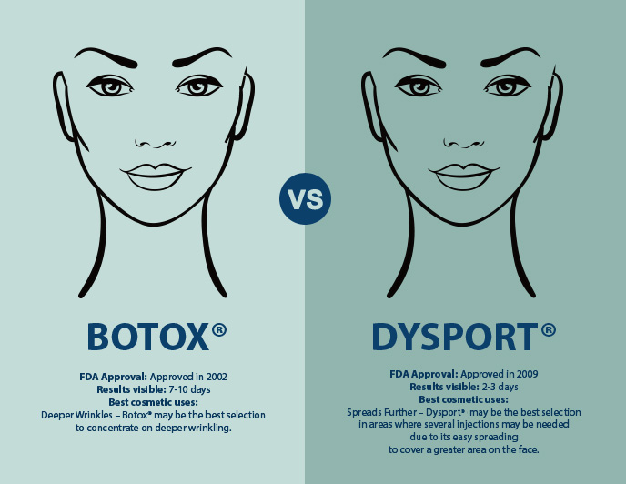 botox-vs-dysport