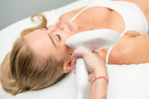 Fractional laser resurfacing - Team Dermatology