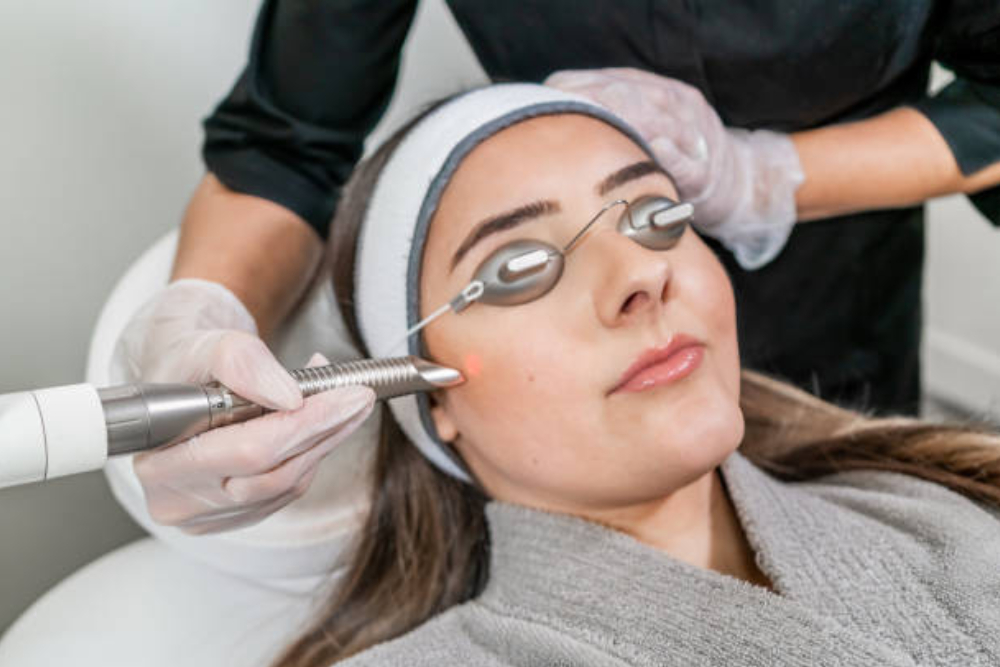 laser treatment