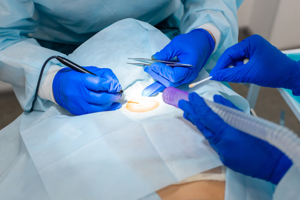 Two healthcare professionals in blue surgical gloves perform a medical procedure. One is using a surgical instrument to operate on a patient, while the other holds a cotton swab and a suction device. The team is dressed in sterile medical attire, indicating a focus on hygiene and patient safety. The setting appears to be an operating room, highlighting a clinical environment dedicated to surgical care. This image illustrates the precision and teamwork involved in surgical procedures, emphasizing the importance of skilled medical support in patient treatment.
