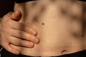 shutterstock 2178218495 1 - Team Dermatology