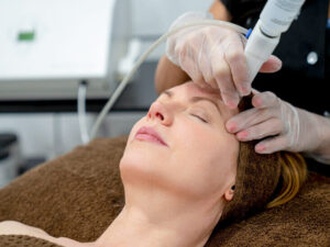 laser genesis - Team Dermatology