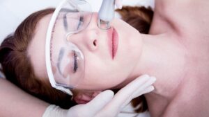 what to know before undergoing laser resurfacing for better skin alt 1440x810 1 - Team Dermatology