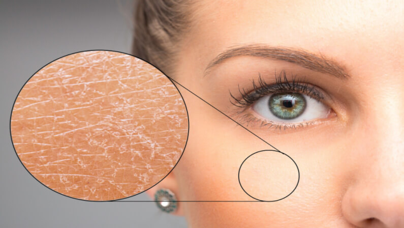 dry skin face