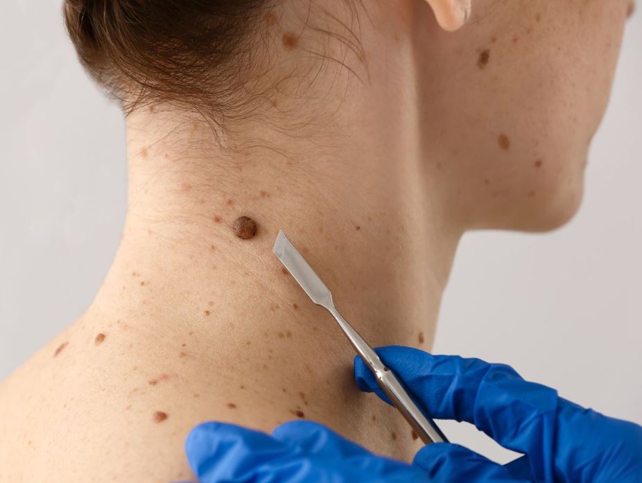 SEP FEATURED 1 - Team Dermatology