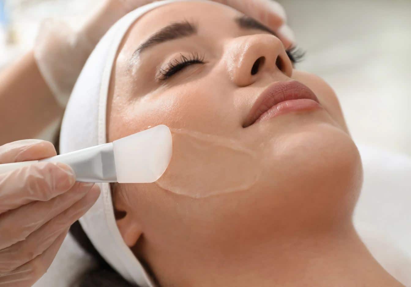 chemical peel 1 - Team Dermatology
