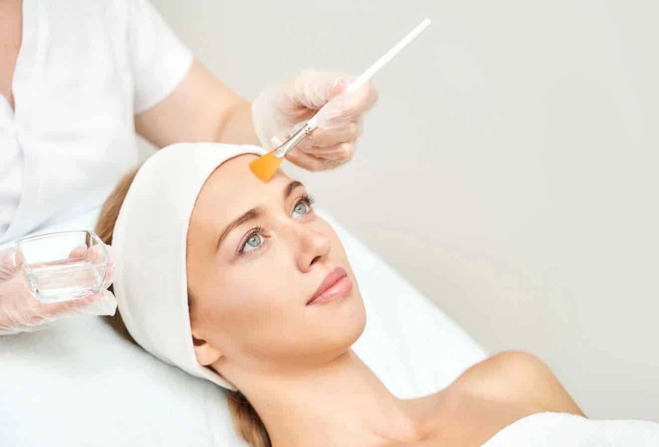 chemical peel 4 - Team Dermatology
